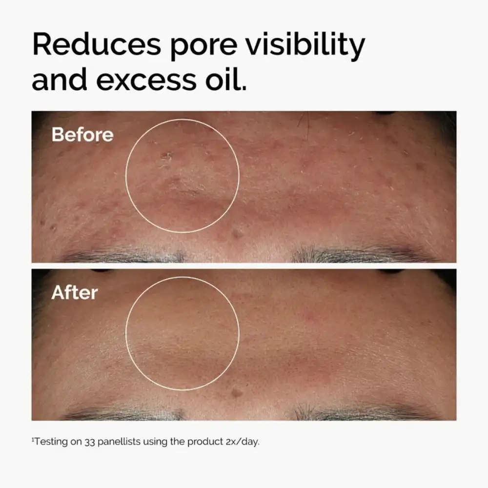 The Ordinary Niacinamide Pore Care The Ordinary Niacinamide Serum for visible pores